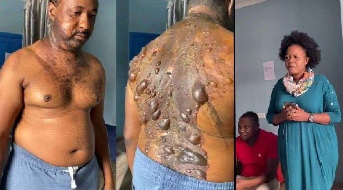 Jealous wife pours hot water on husband after buying new phone for his sidechick in Imo (PHOTOS)
