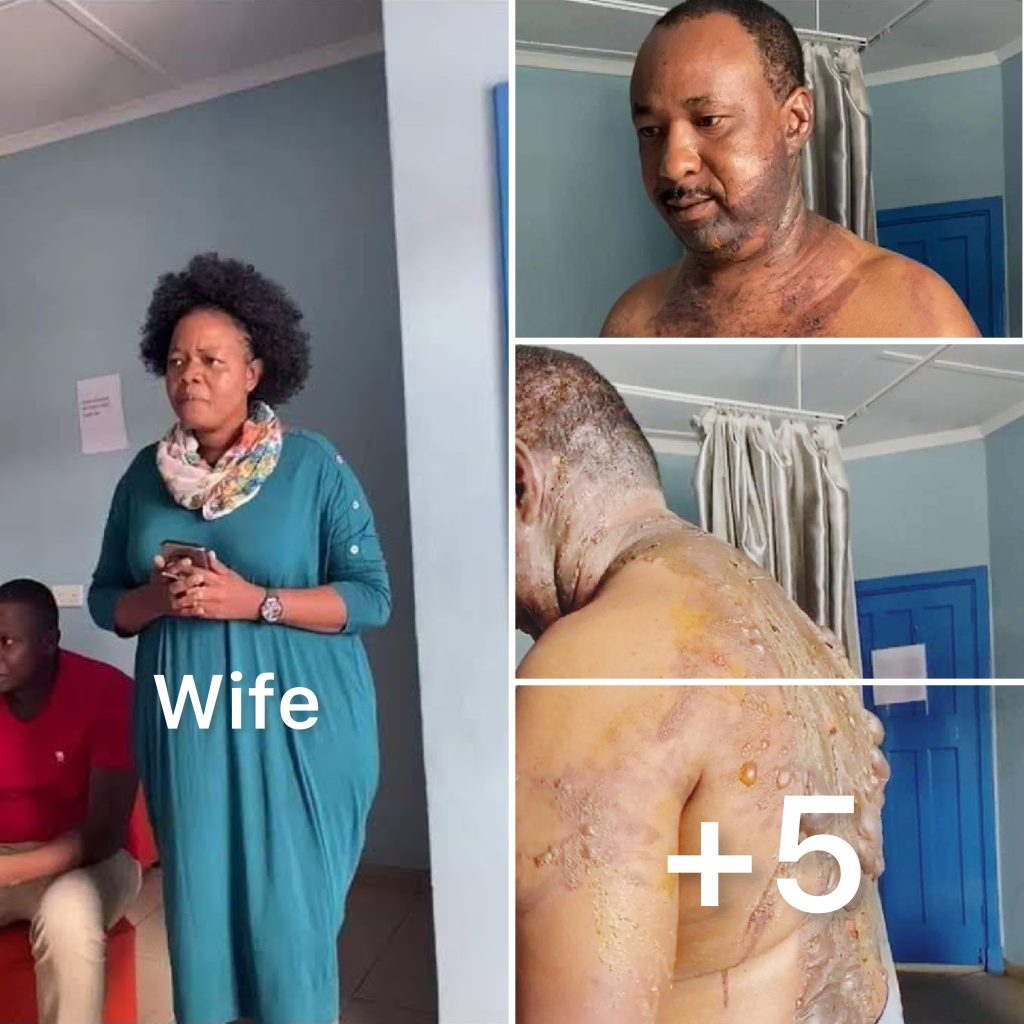 Jealous wife pours hot water on husband after buying new phone for his sidechick in Imo (PHOTOS)