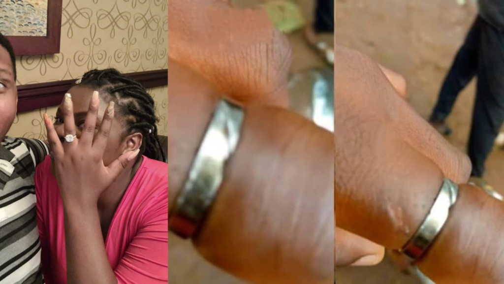Nigerian Lady loses One of her finger from wearing her fiancé’s engagement ring for 10 years (Photos)